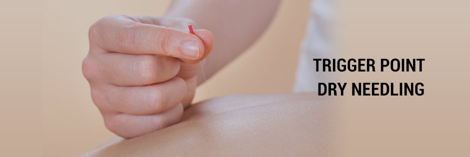 Image dry Needling